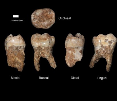 Анализ зубного камня рассказал о рационе людей, живших 400 000 лет назад