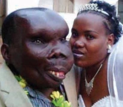 Самый некрасивый мужчина Уганды стал отцом в восьмой раз