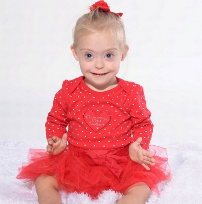 Դաունի համախտանիշով տառապող 2 տարեկան աղջիկն իր ժպիտի շնորհիվ մոդել է դարձել