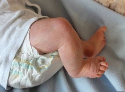 «Շենգավիթ» բժշկական կենտրոնը՝ նորածնային մահվան դեպքի մասին