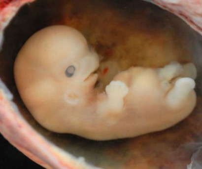 В Нидерландах начнут выращивать человеческие эмбрионы для опытов