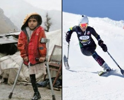 Самый необычный в мире горнолыжник: девочка, потерявшая ногу при землетрясении, катается на лыжах лучше здоровых профессионалов
