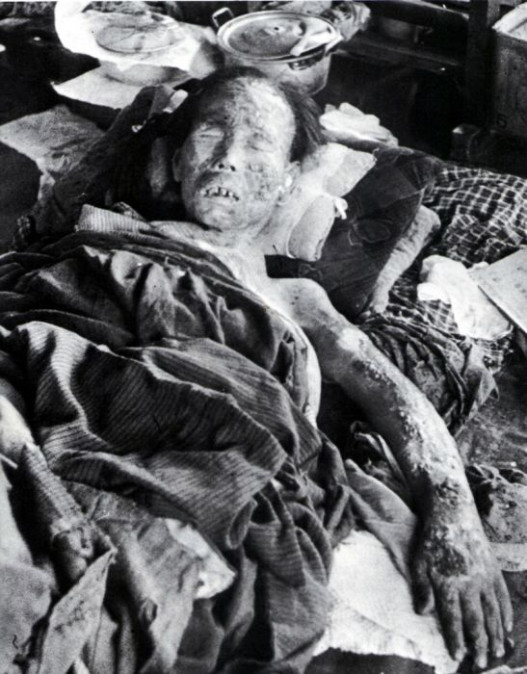 Դաժան լուսանկարներ՝ արված Նագասակիի և Հերոսիմայի ատոմային պայթյուններից հետո
