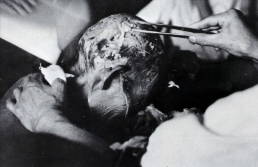 Դաժան լուսանկարներ՝ արված Նագասակիի և Հերոսիմայի ատոմային պայթյուններից հետո