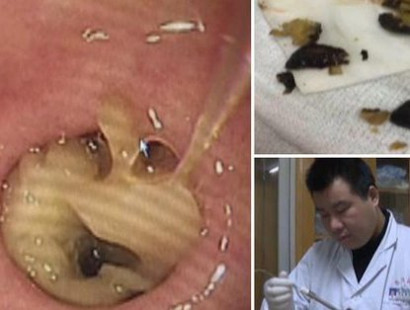 A bizarre video has emerged from China of a doctor removing mushrooms 'growing' in a woman's stomach.