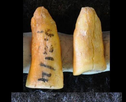 Oldest tooth filling was made by an Ice Age dentist in Italy