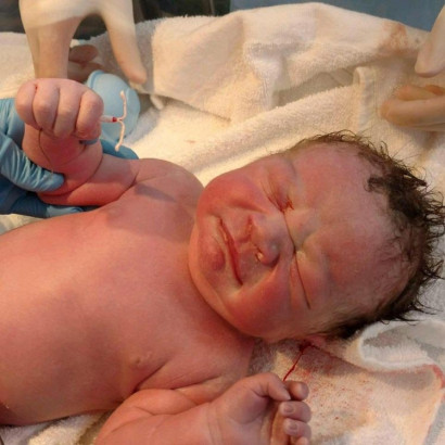 Новорожденный ребёнок позирующий со спиралью, которая должна была предотвратить мамину беременность