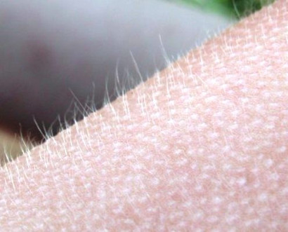 Why do humans get "goosebumps" when they are cold, or under other circumstances?
