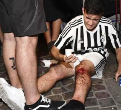 Five seriously injured as Juventus fans in Turin panic over firecrackers