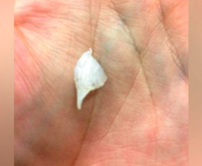 Австралиец нашёл в ломтике хлеба зуб акулы