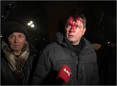 Столкновения полиции и сторонников Саакашвили: есть пострадавшие