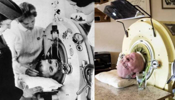 Paul Alexander, who lived in iron lung for more than 70 years, dies at 78