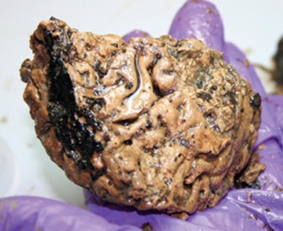 В доисторическом черепе нашли неповрежденный человеческий мозг