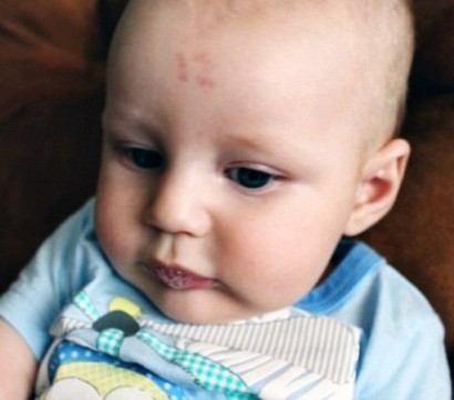 Dozen that birthmark look odd? Baby is born with distinguishable number '12' on his forehead