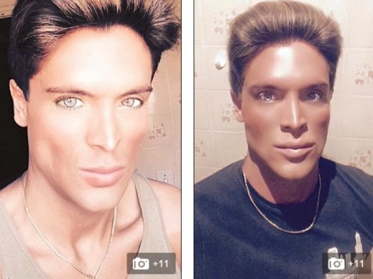 Barbie Wannabes Meet Your Dream Guy After Eight Plastic Surgeries