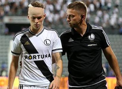 Crowd trouble in Albania gets Legia 3-0 win from UEFA after Europa League match abandoned