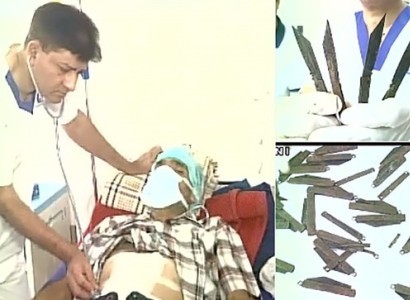 Doctors remove 40 knives from man's stomach in India