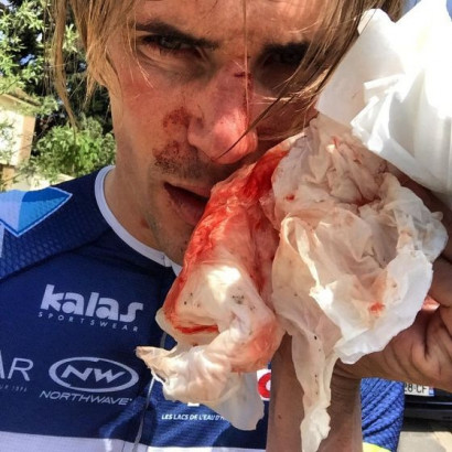 Французского велогонщика Оффредо избили бейсбольной битой во время тренировки