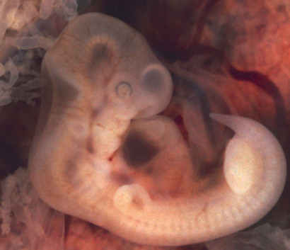 Учёные впервые устранили наследственную болезнь, исправив ген эмбриона