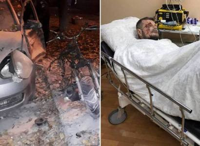 Теракт в Киеве: ранен депутат, погиб его охранник