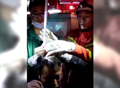 Китайцу вонзился в череп метровый металлический прут, но он выжил
