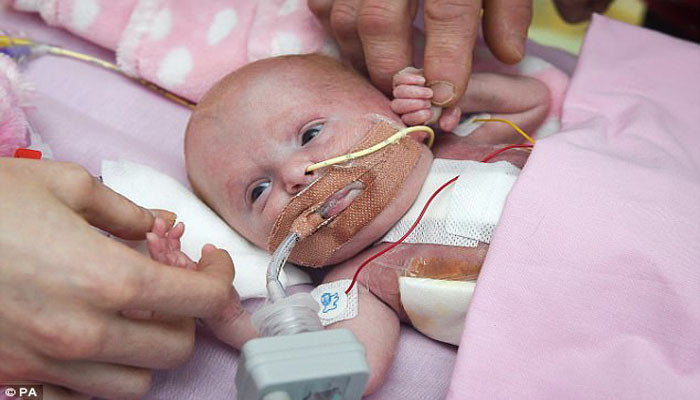 The baby born with her heart growing OUTSIDE her body: Premature girl beats eight-in-a-million odds to survive and defies doctors who gave her 'next to zero' chance