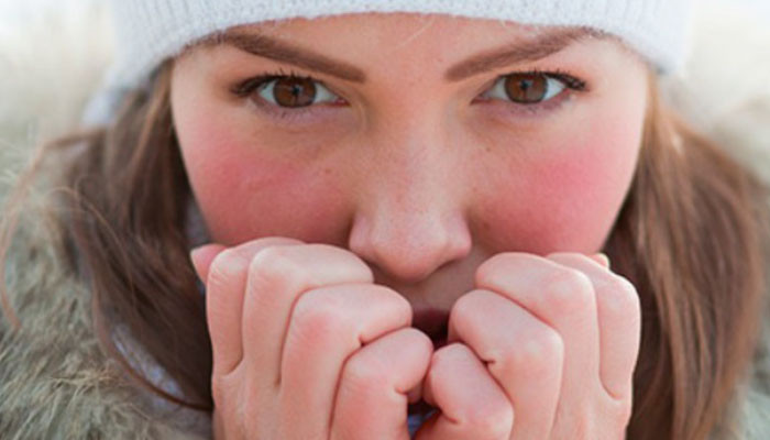 Аллергия на холод: симптомы и лечение