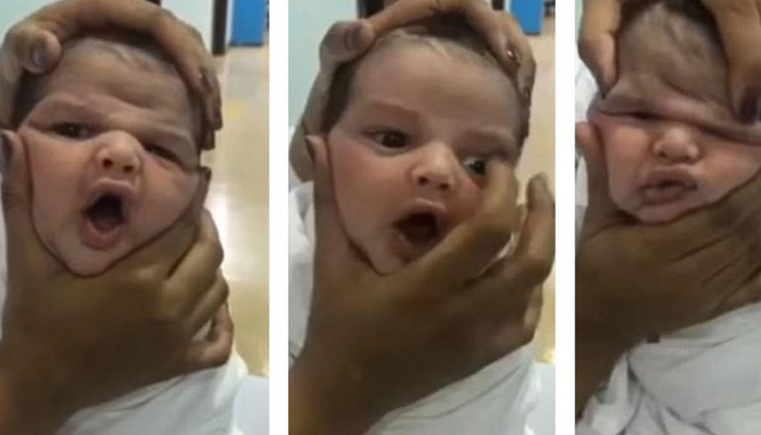 Nurses who filmed themselves squashing a newborn baby's face are fired after the video sparks outrage in Saudi Arabia