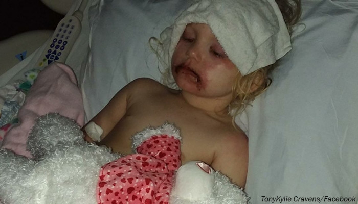 3-year-old rushed to hospital after playing with popular toy – now mom wants to warn people