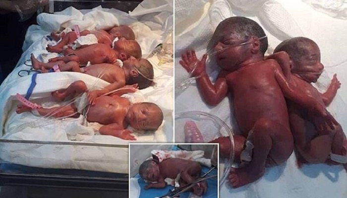 СМИ сообщили о гибели семерых близнецов, родившихся в Ираке