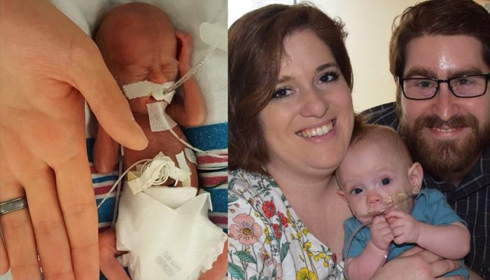 ‘Miracle Baby’ Born At 26 Weeks Comes Home