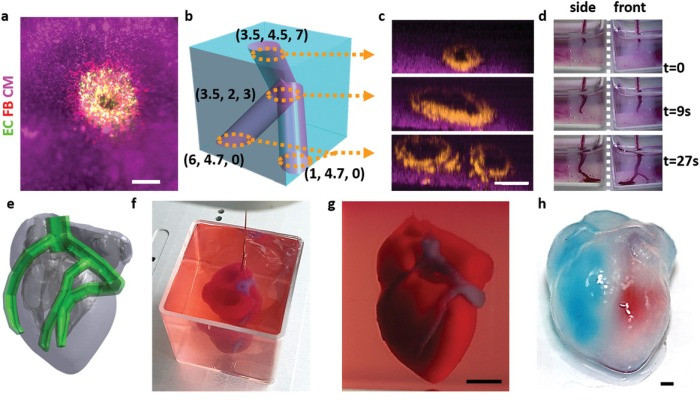 3D Printing of Personalized Thick and Perfusable Cardiac Patches and Hearts