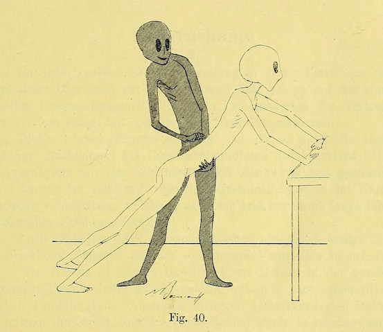 1895 թվականի գինեկոլոգիական ձեռնարկը ապշեցնում է իր բուժման մեթոդներով ու նկարազարդումներով