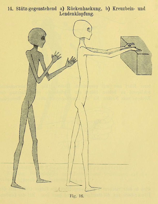 1895 թվականի գինեկոլոգիական ձեռնարկը ապշեցնում է իր բուժման մեթոդներով ու նկարազարդումներով