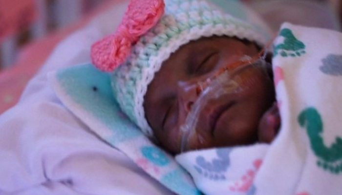 'World's smallest' surviving premature baby released from US hospital