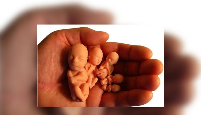 В Луизиане запретили аборты после шести недель беременности
