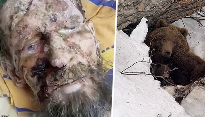 Man Mistaken For Mummy May Never Have Been ‘Attacked By Bear’