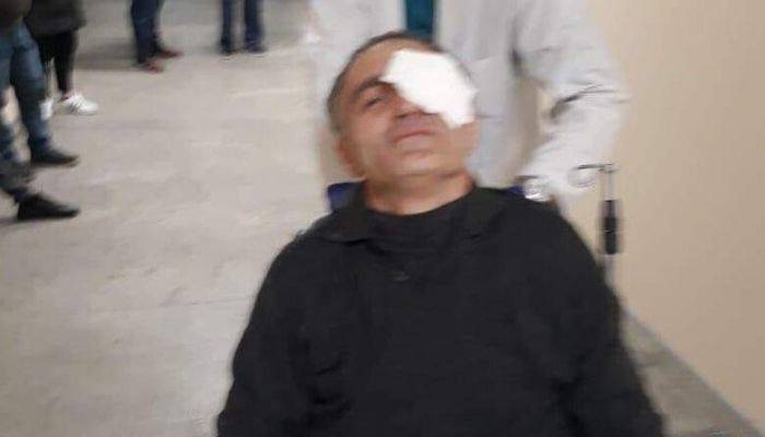 СМИ: пострадавшему при разгоне акции протеста в Тбилиси требуется операция