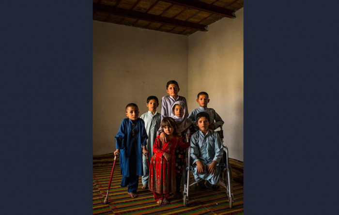 Վիրավոր աֆղանացի երեխաներ