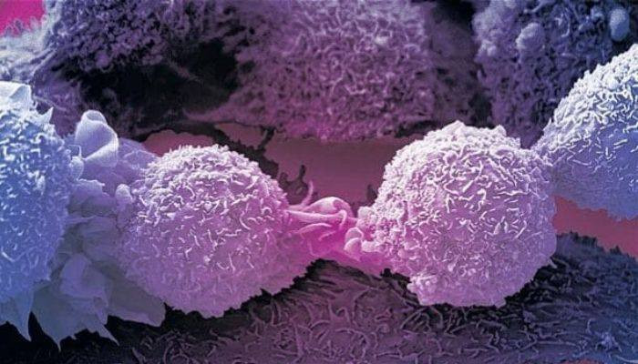 Քարդիֆի համալսարանի հայտնագործությունը կարող է առաջընթաց գրանցել քաղցկեղի դեմ պայքարում․ #TheDailyTelegraph