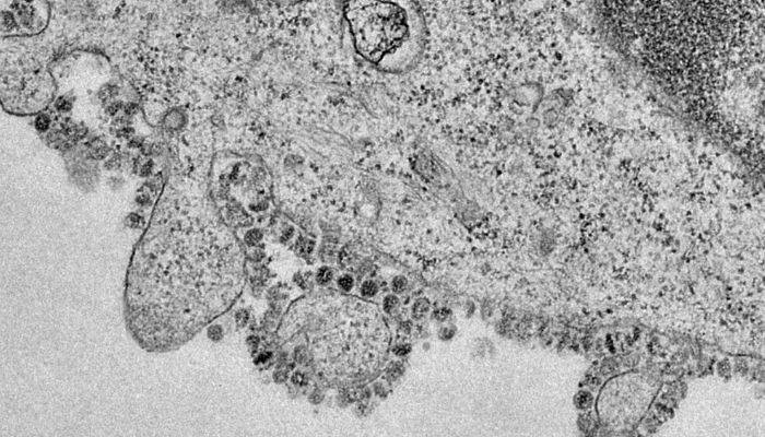 Here are the first images of how coronavirus replicates in cells
