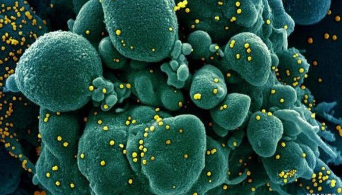Patient infected with two strains of #COVID_19 in Iceland
