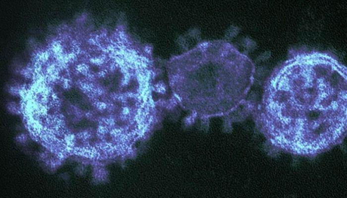 Врачи назвали новый признак заражения коронавирусом. #American Academy of Ophthalmology