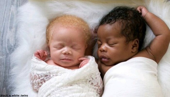 Фотограф родила близнецов разного цвета кожи