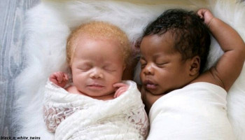 Photographer gives birth to twins, one black and one white – takes amazing photos of albino daughter