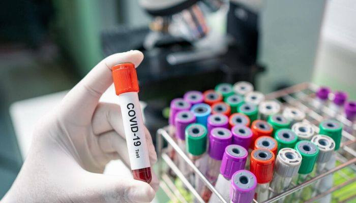 Global coronavirus cases top 4.6 million: Johns Hopkins University