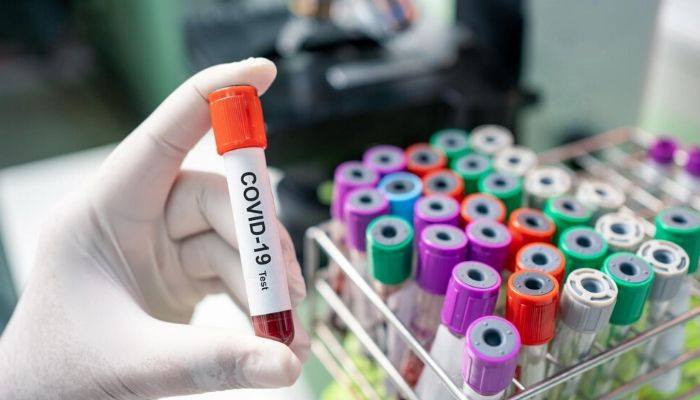 Մոլեկուլային կենսաբանության ինստիտուտը կսկսի կորոնավիրուսային թեստերի արտադրությունը