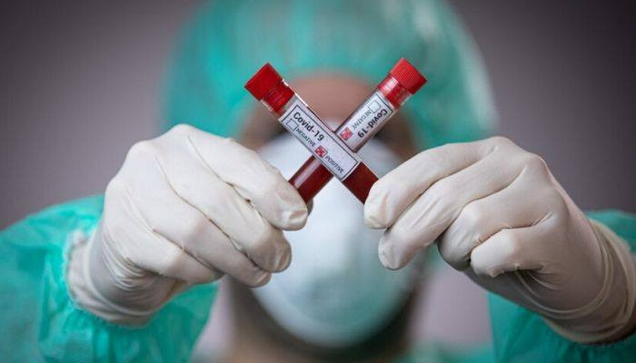В России за сутки выявили 8248 новых заболевших коронавирусом