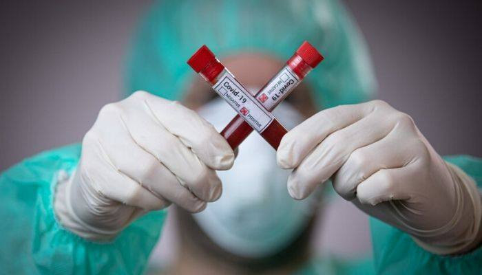 Количество инфицированных коронавирусом в Грузии увеличилось на 9