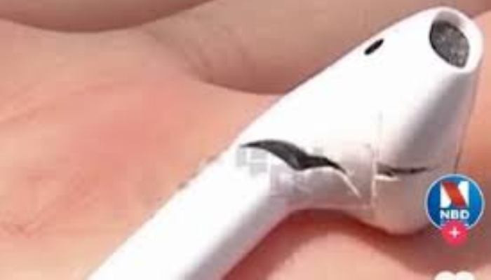 Apple AirPods allegedly explodes while owner was making a call